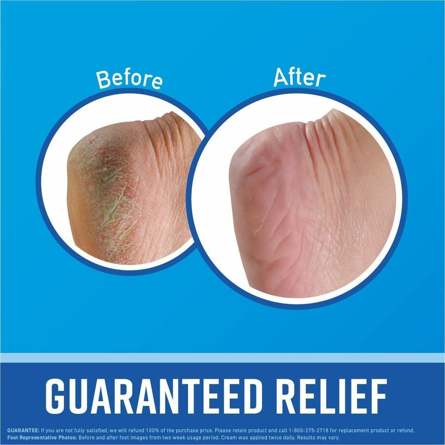 O'Keeffe's Healthy Feet Foot Cream - Cream - 3.20 fl oz - For Dry Skin - Cracked/Scaly Skin, Rough Skin - Non-greasy, Moisturising - 1 Each